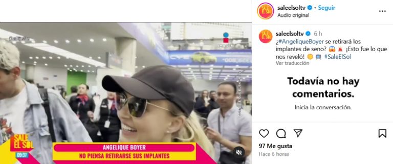 En una entrevista para 'Sale el Sol' mencionó que no se retirará los implantes
