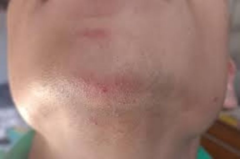 Grave un adolescente en Nogales tras brutal golpiza a manos de varios agresores