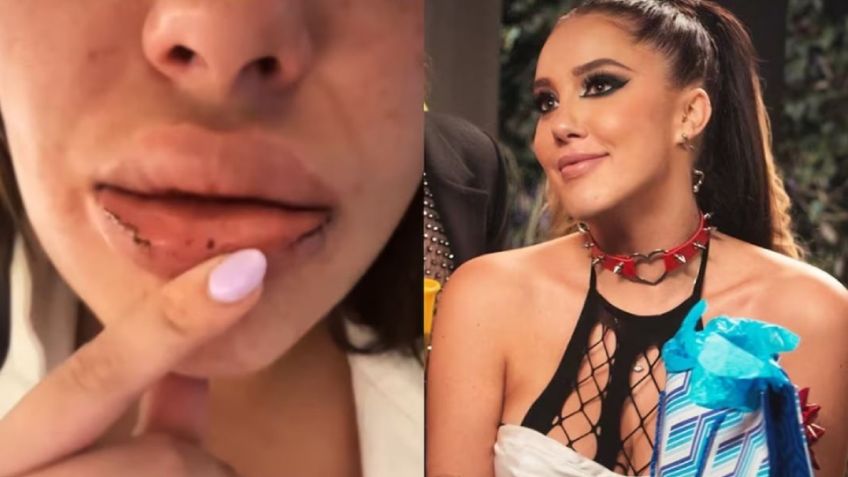 Isa Castro denuncia a su novio por violencia: La estrella de Televisa expone todo en VIDEO