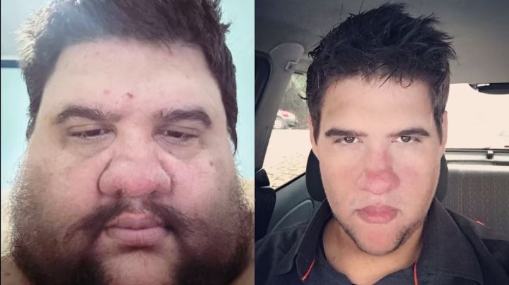 Muere famoso influencer fitness tras infarto fulminante tras lucha contra la obesidad