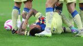 Foto ilustrativa de la nota titulada: América sigue con las lesiones; Águilas pierden a dos elementos en partido contra Cruz Azul