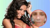 Foto ilustrativa de la nota titulada: Famosa actriz de Televisa acaba desfigurada tras mala cirugía estética; filtran impactantes FOTOS