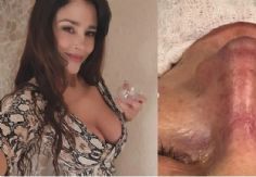 Foto ilustrativa de nota La modelo argentina Dorismar termina desfigurada después de cirugía estética y más en  Tribuna Top 3 Espectáculos