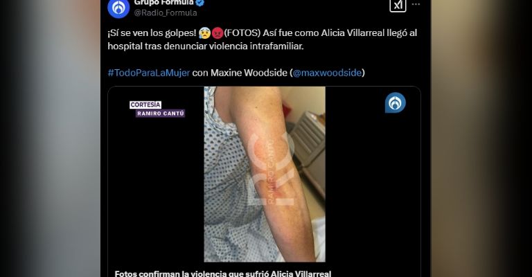 Alicia Villarreal ya demandaría Cruz y filtran fotos de las lesiones tras golpiza