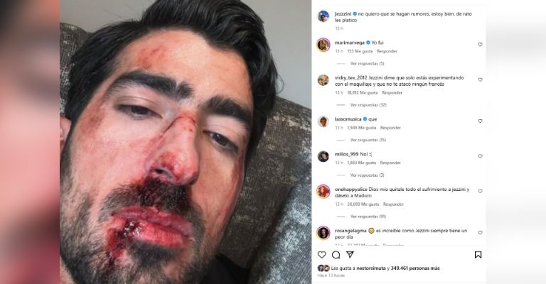 Jezzini alertó a sus seguidores tras aparecer brutalmente golpeado