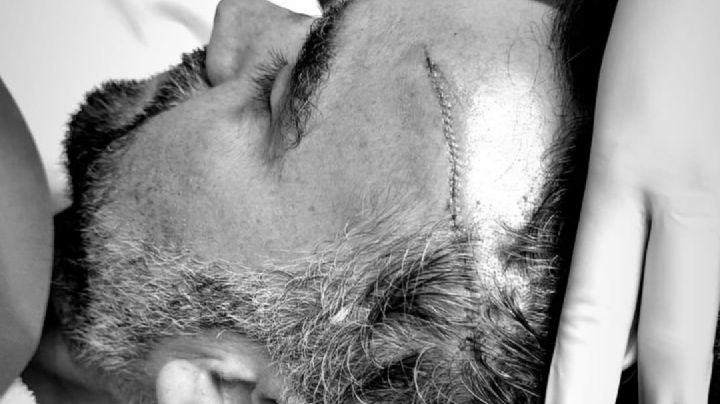 Enrique Acevedo regresa a En Punto tras accidente que casi termina en tragedia ¿Quién es?