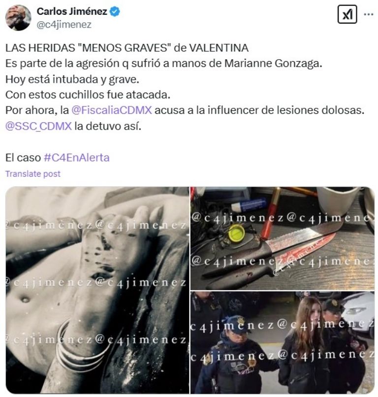 Marianne Gonzaga usó dos cuchillos de cocina para apuñalar a Valentina