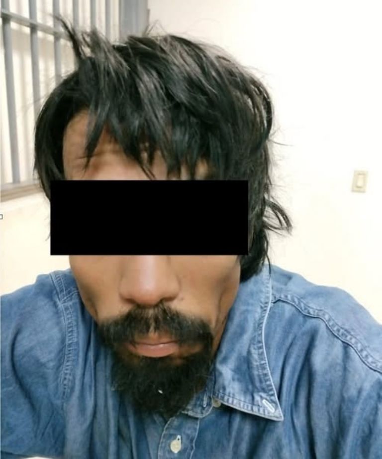 Adrián Rodrigo 'N' molesto con su hermana la agredió con unas tijeras