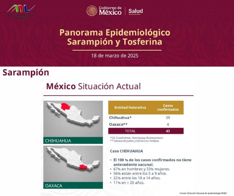 Sarampión en México