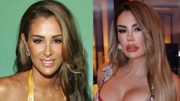 Antes y después de Ninel Conde