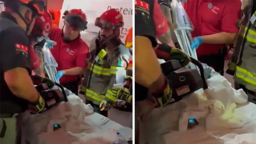 Menor de un año pierde una mano y antebrazo tras accidente con máquina en Nuevo León