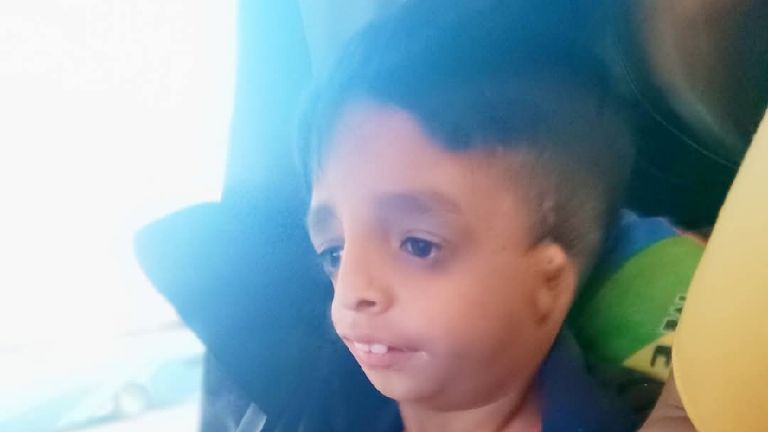 Cajeme Buscan apoyo para poder llevar a operar a Eduardito, paciente de Treacher Collins