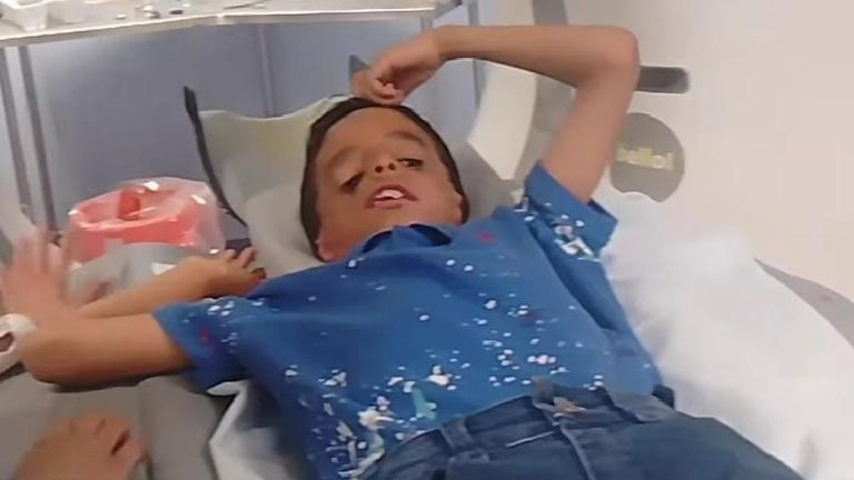 Cajeme Buscan apoyo para poder llevar a operar a Eduardito, paciente de Treacher Collins