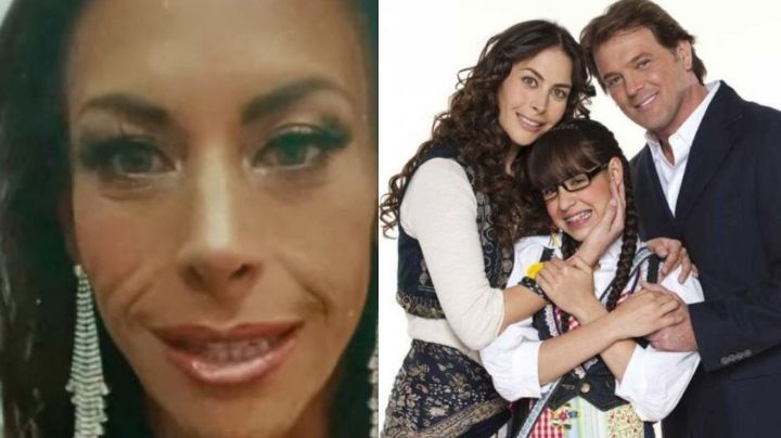 Acabó desfigurada: Tras retiro de Televisa, actriz da triste noticia por problema de salud