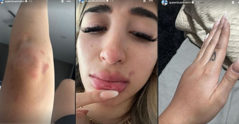 Brandon Castañeda niega violencia contra Queen Buenrostro y en llanto anuncia demanda por acoso