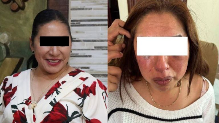 Fiscalía de Edomex Cae alcaldesa de Capulhuac por agresión contra psicóloga del DIF