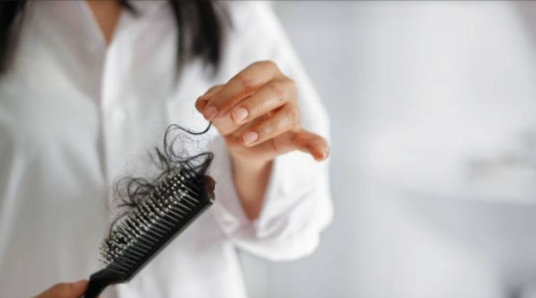 ¿Tienes caída del cabello?, esto puedes hacer/ Créditos: Internet