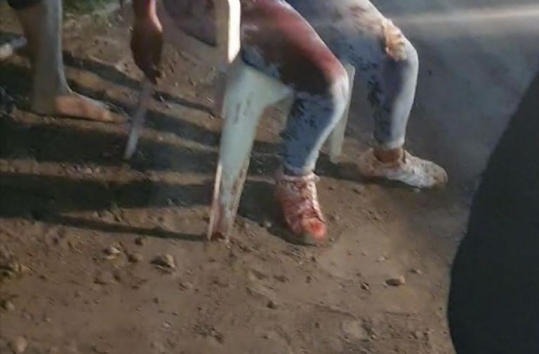 La víctima tuvo que esperar varios minutos a la llegada de Cruz Roja