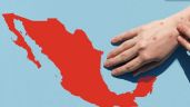 Foto ilustrativa de la nota titulada Alerta: México suma 12 muertes por sarampión; prevén eliminar casos este mismo año