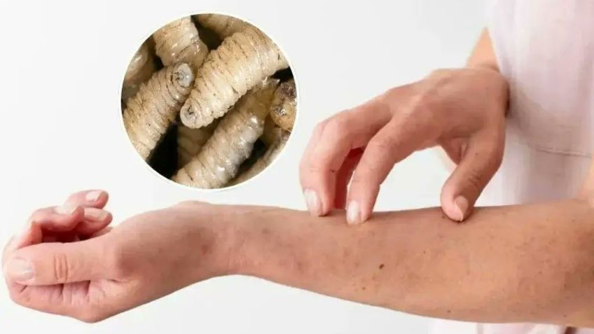 Reapertura de la frontera de EU al ganado: Confirman 30 casos de gusano barrenador en humanos