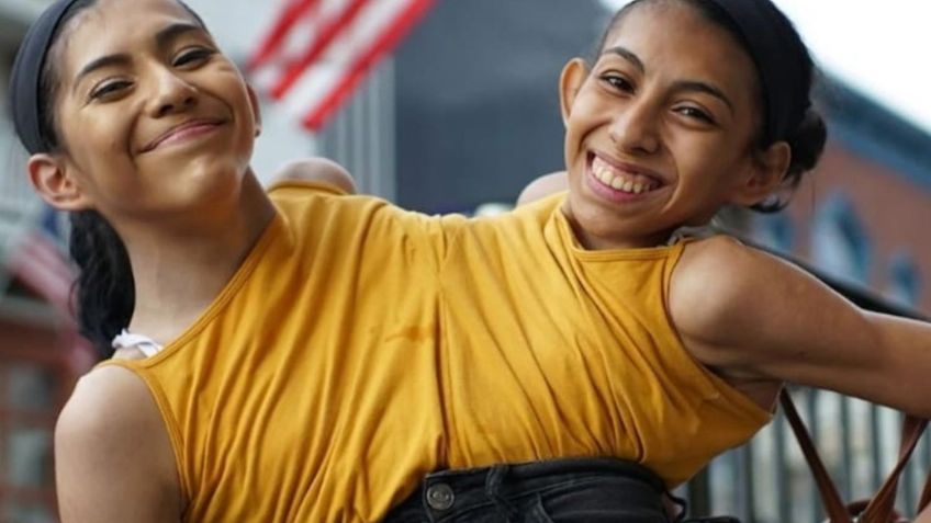 ¿Quiénes son Lupita y Carmen, las siamesas que conquistaron con su valerosa historia?