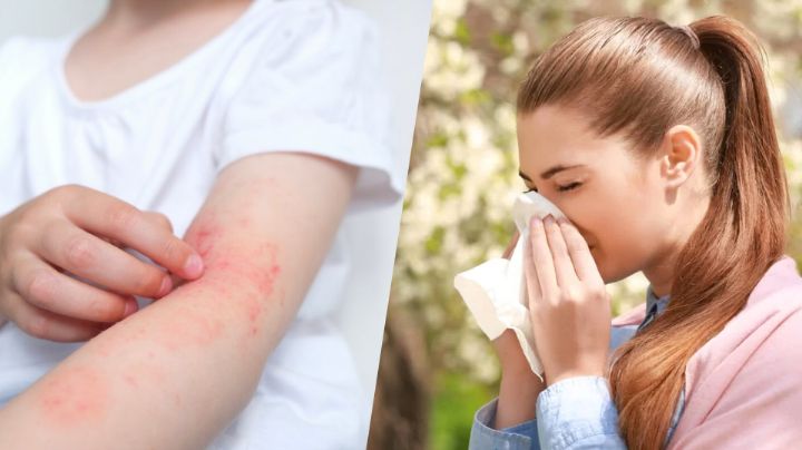 Día Mundial de la Alergia, ¿por qué se celebra hoy 8 de julio y dónde se originó este día?