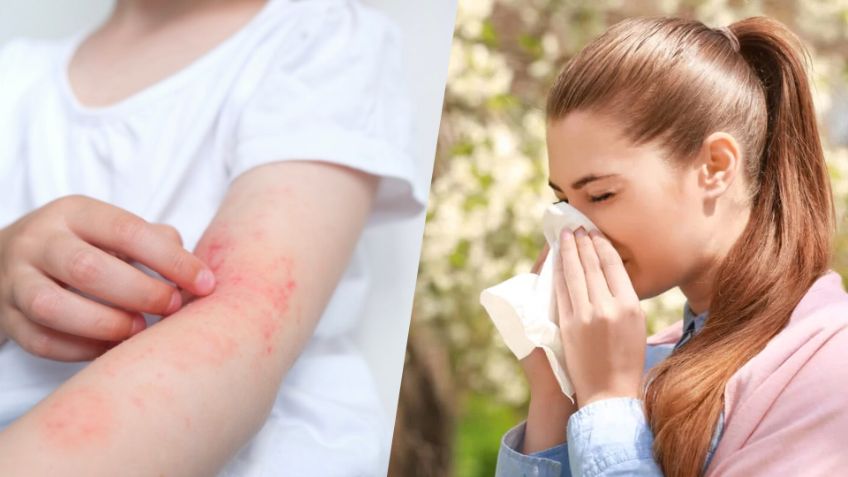 Día Mundial de la Alergia, ¿por qué se celebra hoy 8 de julio y dónde se originó este día?