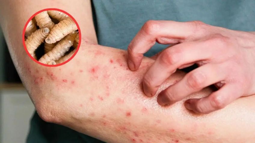 Yucatán confirma primer caso de gusano barrenador en humanos