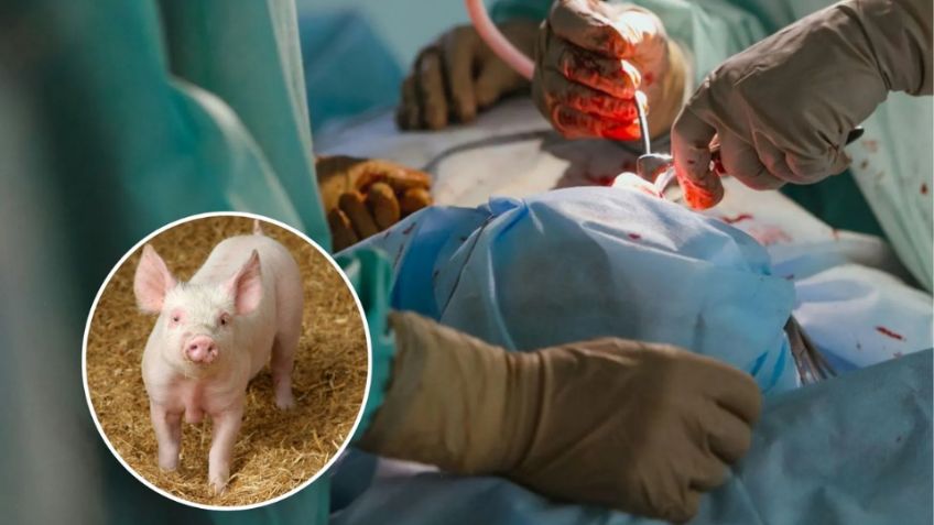 Científicos chinos realizan el primer trasplante de pulmón de cerdo a una persona en coma