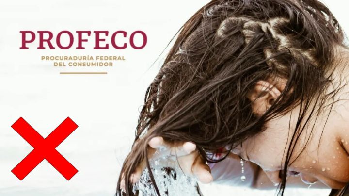 Alerta Profeco: Este shampoo podría provocar infecciones en los ojos y piel tras una bacteria
