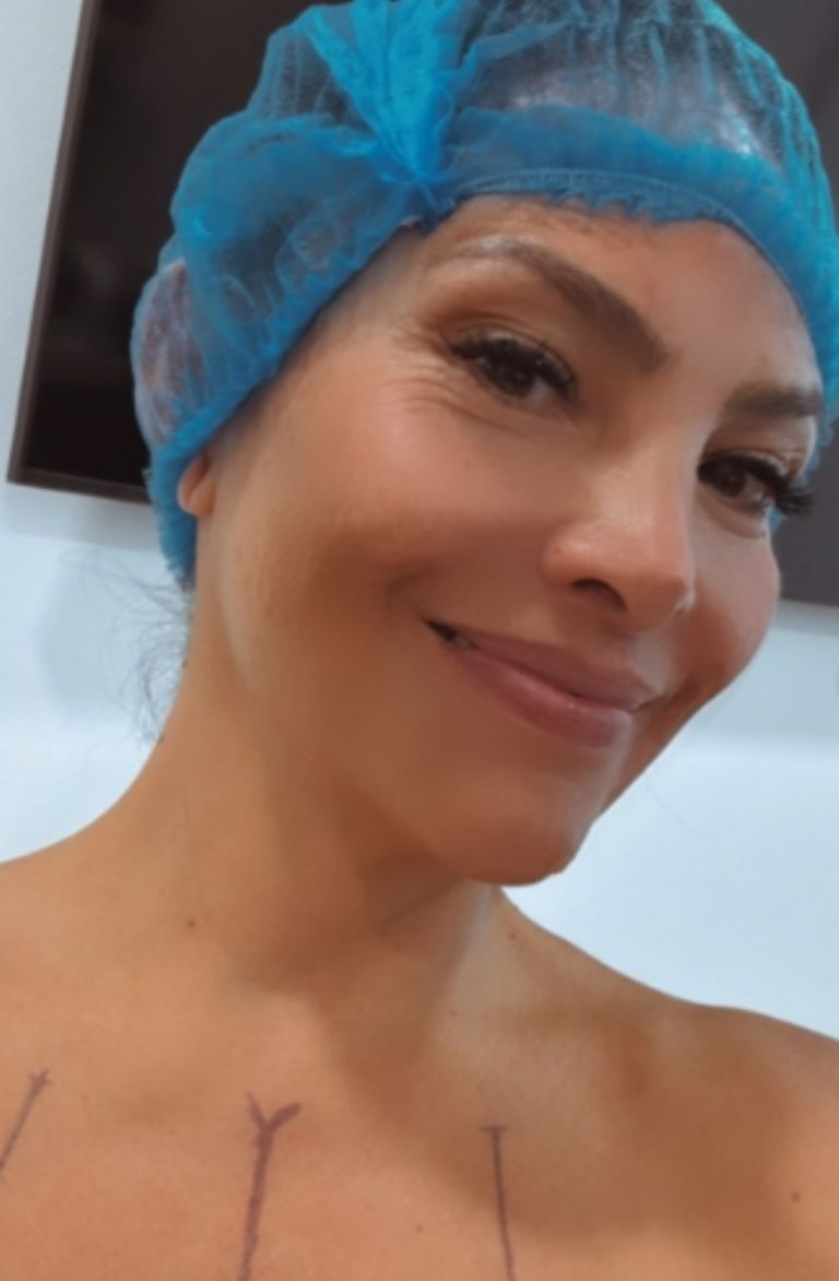 La cirugía fue un éxito 