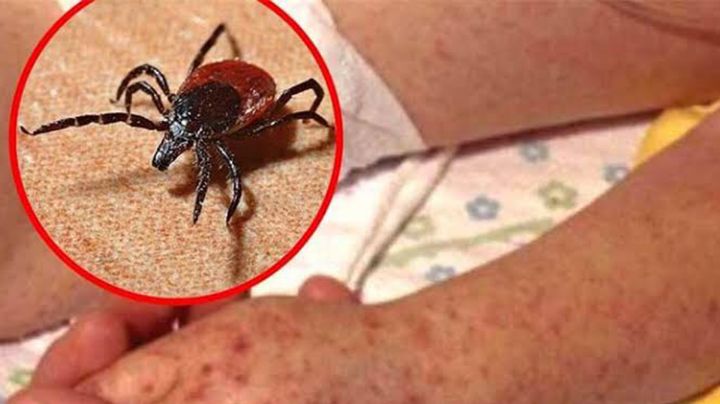 Navojoa: Región del Mayo suma 12 defunciones por rickettsia en 2025