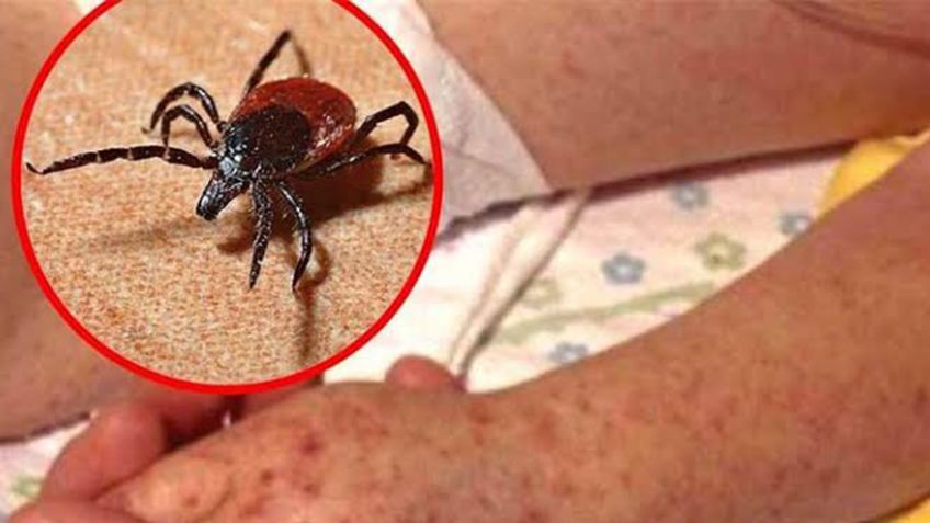 Navojoa: Región del Mayo suma 12 defunciones por rickettsia en 2025