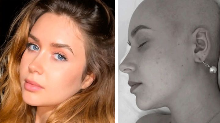 La imagen que conmueve: Exconcursante española de 'Masterchef Junior' enfrenta cáncer