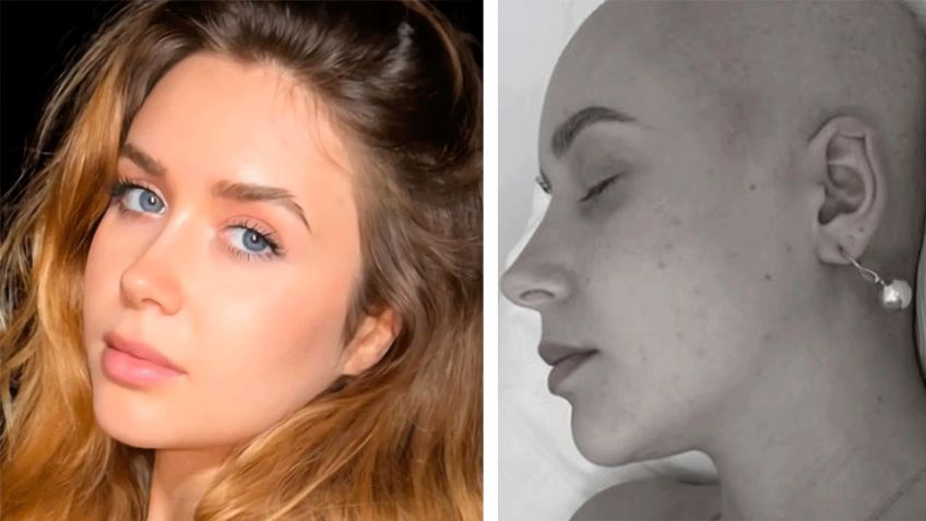 La imagen que conmueve: Exconcursante española de 'Masterchef Junior' enfrenta cáncer