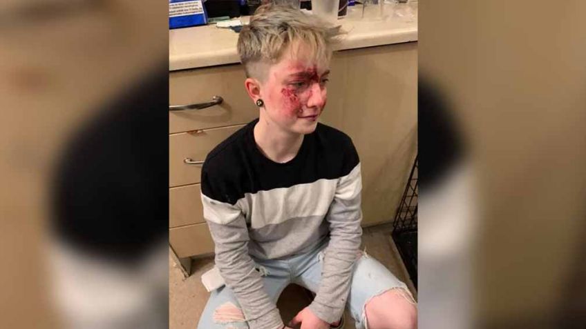 Joven muestra su rostro ensangrentado tras ser víctima de ataque homofóbico