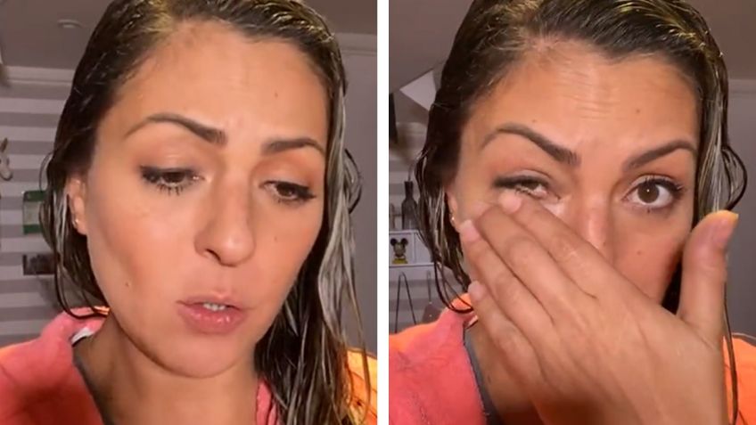 Mariana Ochoa de OV7 sufre accidente y muestra su "fractura" en Instagram