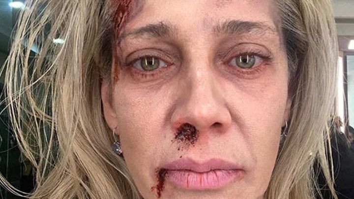 VIDEO: Cynthia Klitbo sufre tremenda caída al realizar deporte extremo con su hija