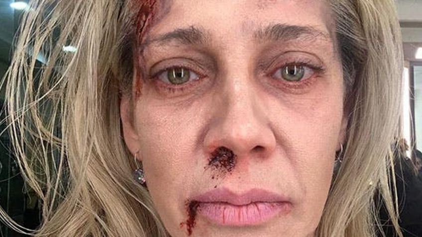 VIDEO: Cynthia Klitbo sufre tremenda caída al realizar deporte extremo con su hija