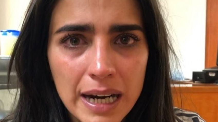 ¡Se quemó la cara! Bárbara de Regil sufre terrible accidente en su propio hogar