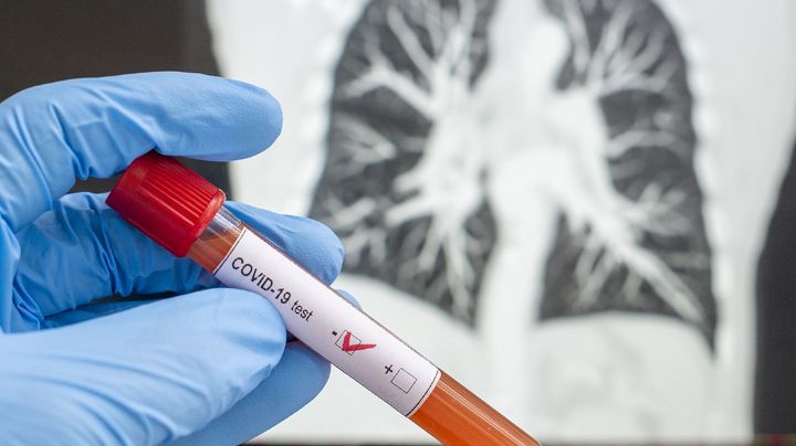 Estudio revela el peligro de asintomáticos con Covid-19: "Pueden contagiar a 400 personas"