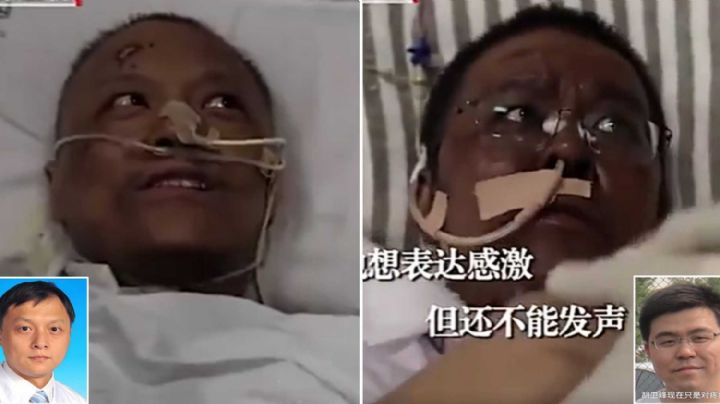 Muere uno de los doctores cuya piel obscureció a causa del Covid-19