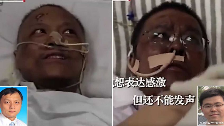 Muere uno de los doctores cuya piel obscureció a causa del Covid-19