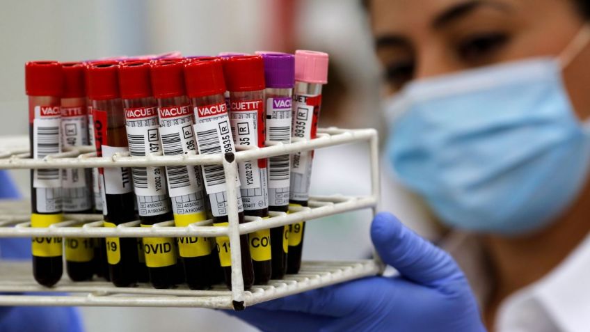 Ayuda Covid-19: Israel usa "vacuna pasiva" desarrollada de pacientes recuperados