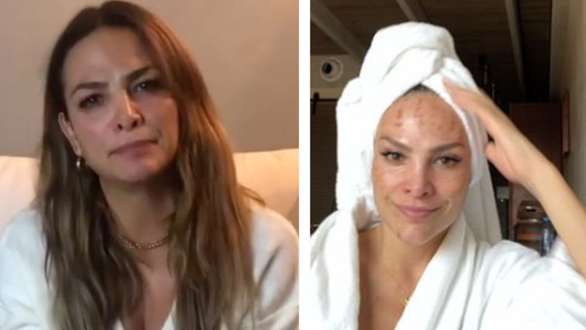 ¿Hundida en depresión? Fabiola Campomanes reaparece en 'Sale el Sol' tras destrozarse el rostro