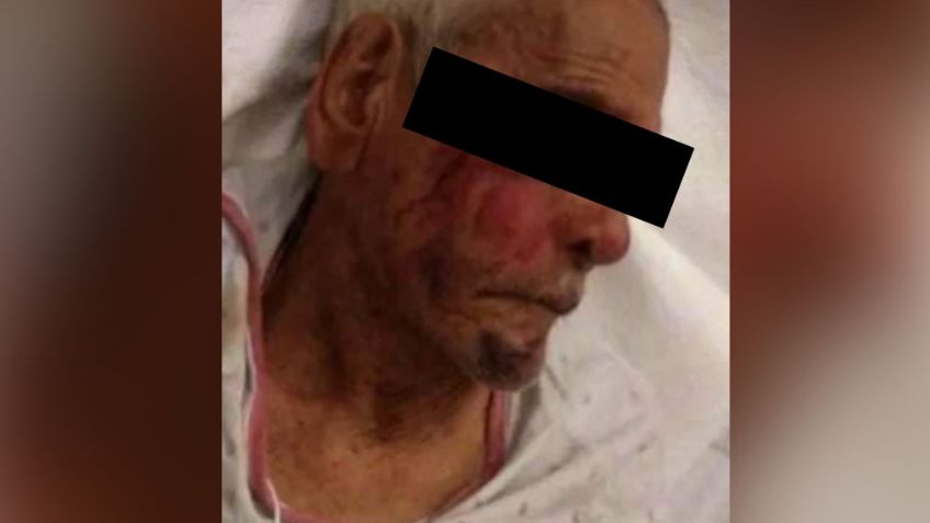 Señor de la tercera edad recibe salvaje golpiza de un joven por razones desconocidas