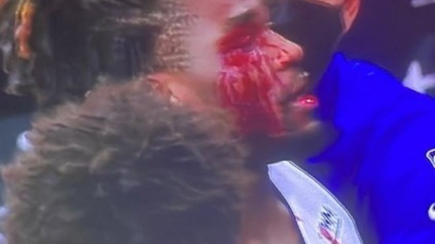 ¡Lo echan! LeBron James golpea a jugador de los Pistones y ambos se van expulsados