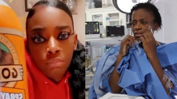 Mujer que se puso pegamento Gorilla en el cabello se somete a este procedimiento; así quedó