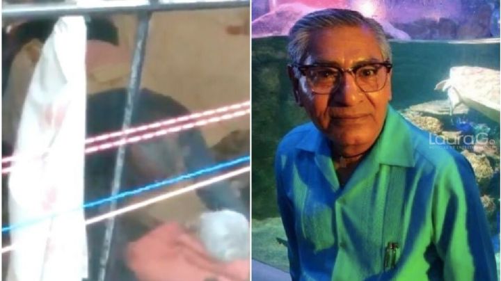 ¡Indignante! Así quedó la 'abuelita' de Tlalpan golpeada por su propio hijo
