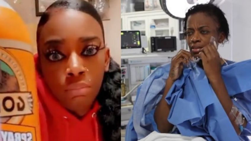 Mujer que se puso pegamento Gorilla en el cabello se somete a este procedimiento; así quedó